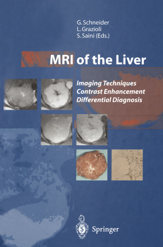 MRI of the Liver: Imaging Techniques Contrast Enhancement Differential Diagnosis