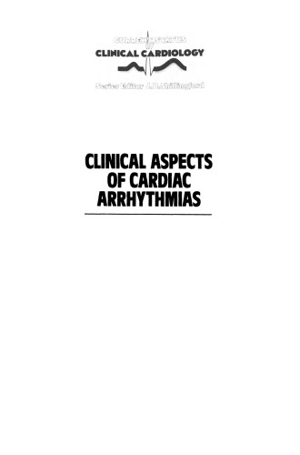 Clinical Aspects of Cardiac Arrhythmias
