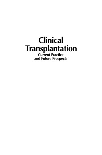 Clinical Transplantation: Current Practice and Future Prospects