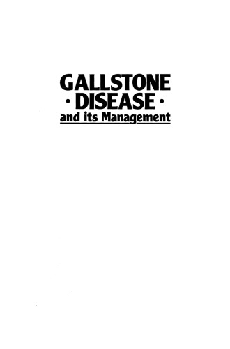 Gallstone Disease and its Management