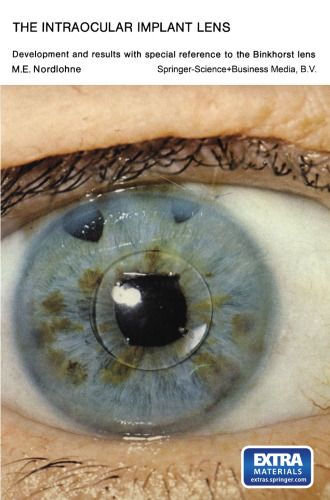The Intraocular Implant Lens Development and Results with Special Reference to the Binkhorst Lens: Proefschrift