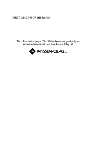 SPECT Imaging of the Brain