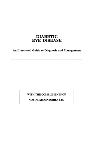 Diabetic Eye Disease: An Illustrated Guide to Diagnosis and Management