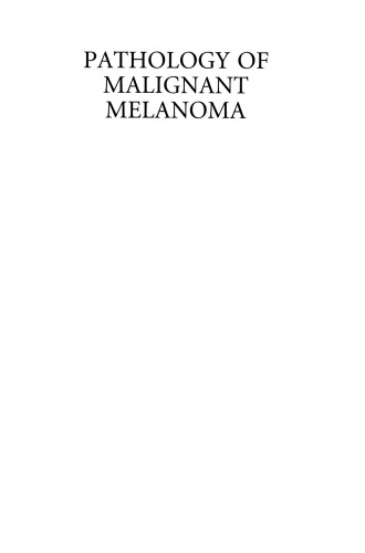 Pathology of Malignant Melanoma