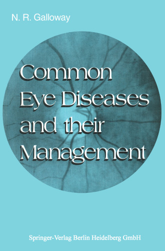 Common Eye Diseases and their Management