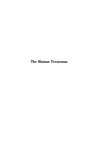 The Human Teratomas: Experimental and Clinical Biology