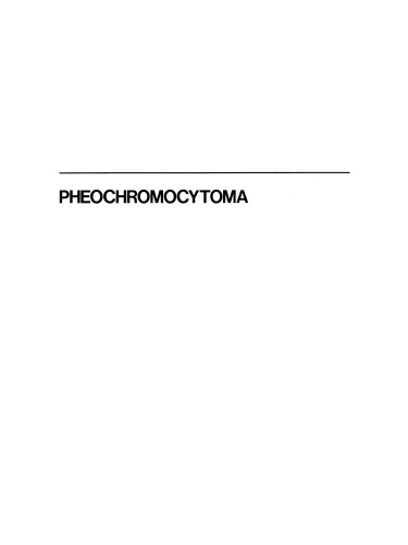 Pheochromocytoma