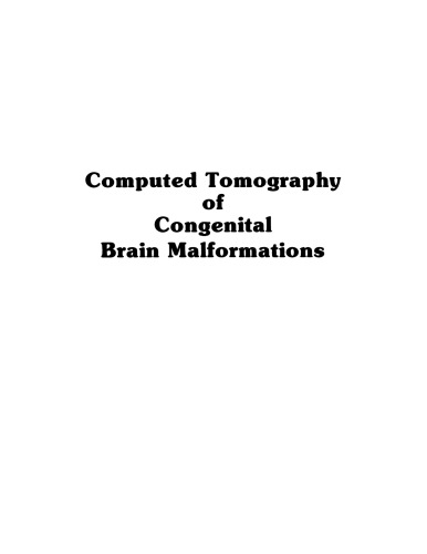 Computed Tomography of Congenital Brain Malformations