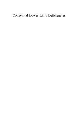 Congenital Lower Limb Deficiencies