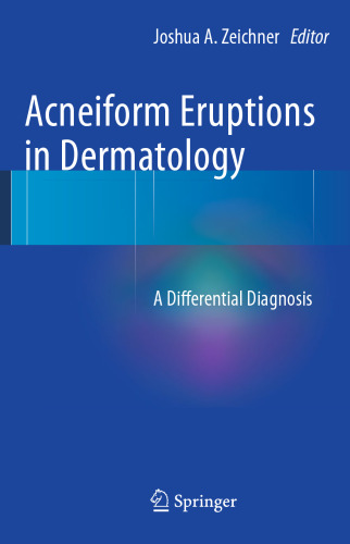 Acneiform Eruptions in Dermatology: A Differential Diagnosis