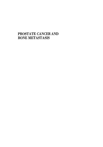 Prostate Cancer and Bone Metastasis
