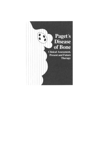 Paget’s Disease of Bone: Clinical Assessment, Present and Future Therapy Proceedings of the Symposium on the Treatment of Paget’s Disease of Bone, held October 20, 1989 in New York City
