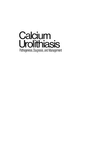 Calcium Urolithiasis: Pathogenesis, Diagnosis, and Management