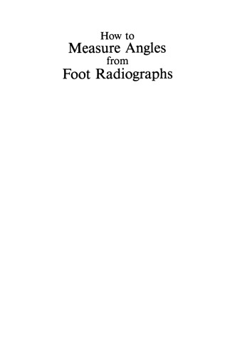 How to Measure Angles from Foot Radiographs: A Primer