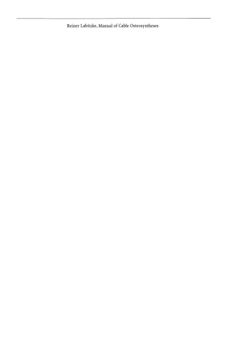 Manual of Cable Osteosyntheses: History, Technical Basis, Biomechanics of the Tension Band Principle, and Instructions for Operation