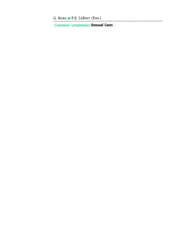 Cutaneous Lymphomas: Unusual Cases