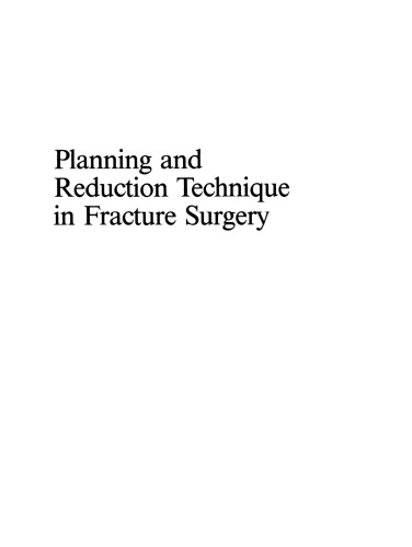 Planning and Reduction Technique in Fracture Surgery