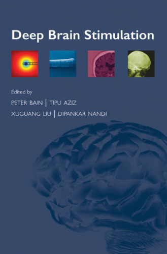 Deep Brain Stimulation