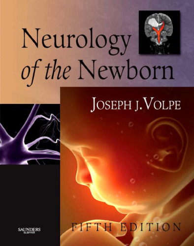 Neurology of the Newborn, 5e