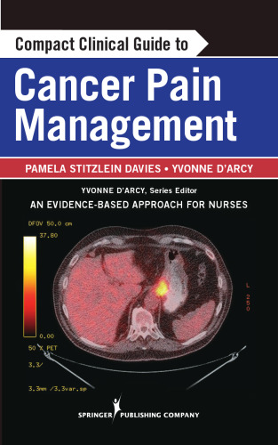 Compact Clinical Guide to Cancer Pain Management: An Evidence-Based Approach for Nurses