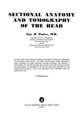 Sectional Anatomy and Tomography of the Head