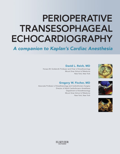 Perioperative Transesophageal Echocardiography