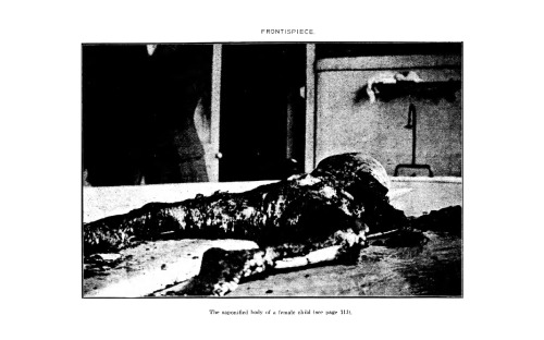 A Text-book of Medical Jurisprudence and Toxicology