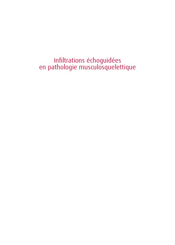 Infiltrations échoguidées