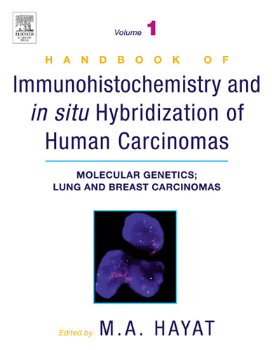 Molecular Genetics; Lung and Breast Carcinomas