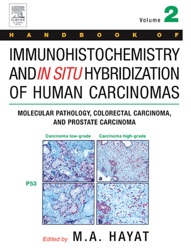 Molecular Pathology, Colorectal Carcinoma, and Prostate Carcinoma