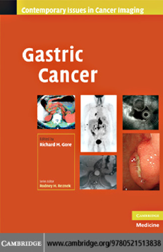 Gastric Cancer