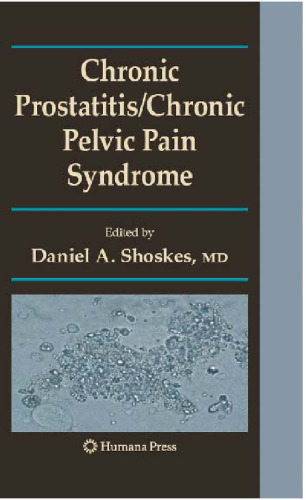 Chronic prostatitis. Chronic pelvic pain syndrome