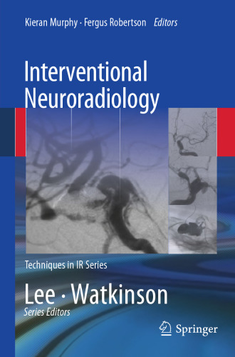 Interventional Neuroradiology