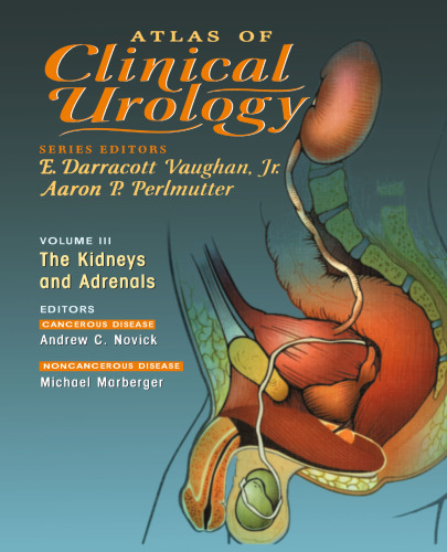 Atlas of Clinical Urology: The Kidneys and Adrenals
