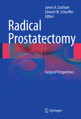 Radical Prostatectomy: Surgical Perspectives
