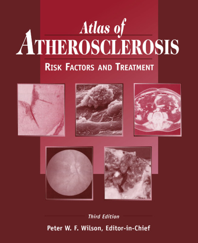 Atlas of Atherosclerosis: Risk Factors and Treatment