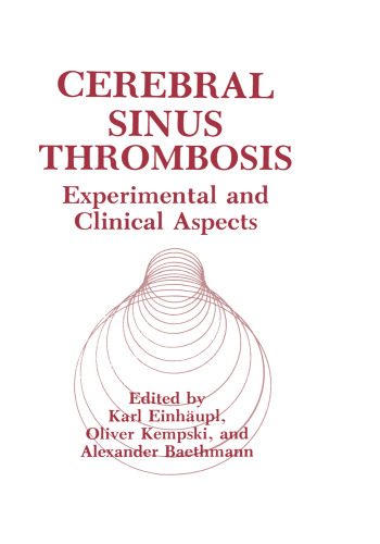 Cerebral Sinus Thrombosis: Experimental and Clinical Aspects