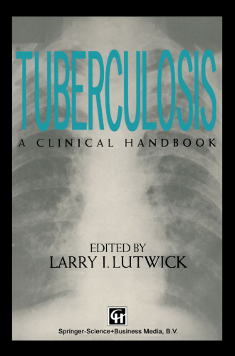Tuberculosis