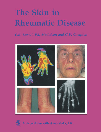 The Skin in Rheumatic Disease