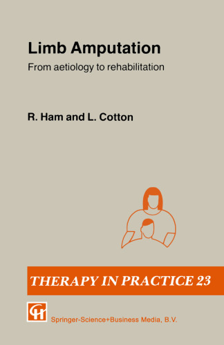 Limb Amputation: From aetiology to rehabilitation