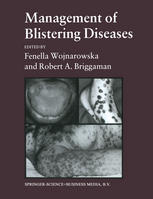 Management of Blistering Diseases