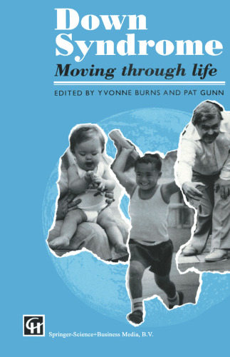 Down Syndrome: Moving through life