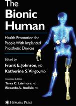 The Bionic Human: Health Promotion for People With Implanted Prosthetic Devices