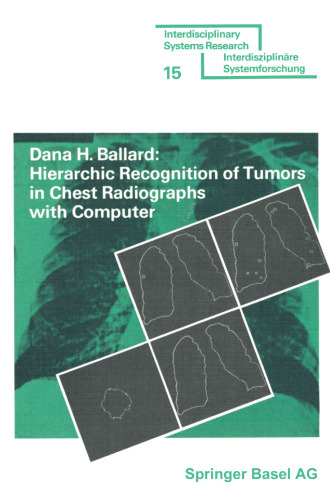 Hierarchic Recognition of Tumors in Chest Radiographs with Computer