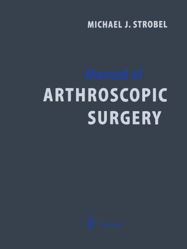 Manual of Arthroscopic Surgery