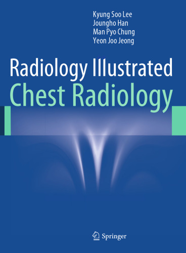 Radiology Illustrated: Chest Radiology