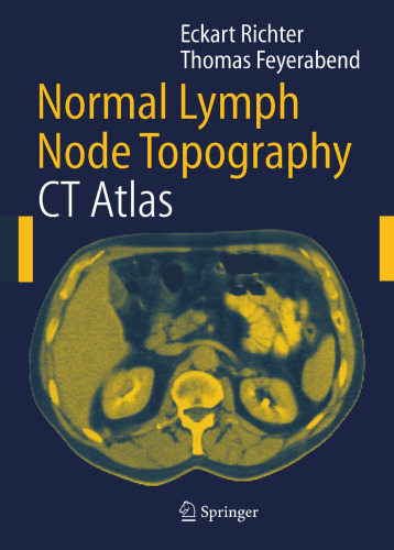 Normal Lymph Node Topography: CT Atlas