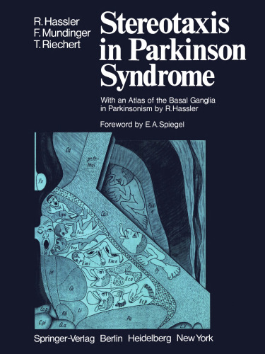 Stereotaxis in Parkinson Syndrome: Clinical-Anatomical Contributions to Its Pathophysiology
