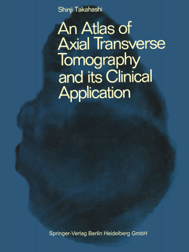 An Atlas of Axial Transverse Tomography and its Clinical Application