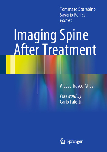 Imaging Spine After Treatment: A Case-based Atlas